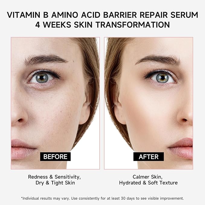 Vitamin B12 Serum for Face - Vitamin B Complex Ampoule with Glutathione,Hyaluronic Acid, Glycine&Arginine,Antioxidant Brightening Hydrating Face Serum for Dry,Sensitive Skin,1.5ml x 30