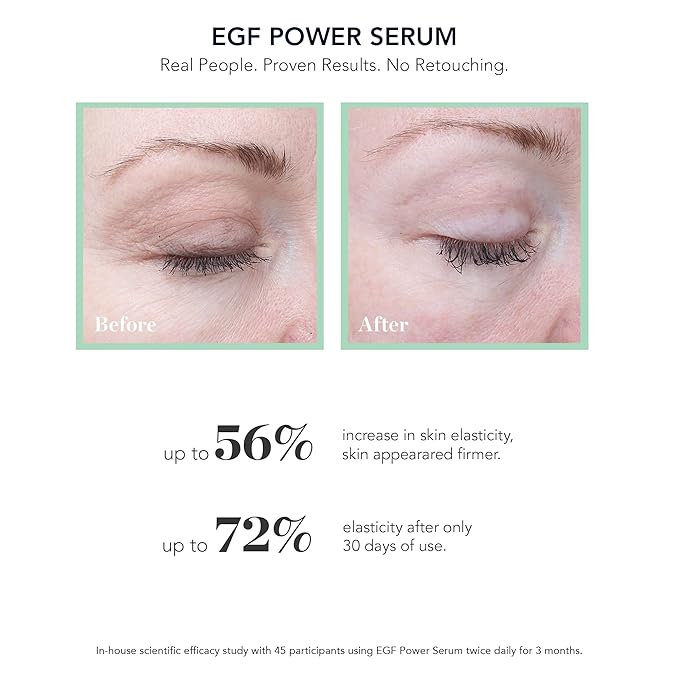 BIOEFFECT EGF Power Serum | Barley-Derived EGF + KGF + Hyaluronic Acid | Intensive Anti-Aging Face Treatment for Deep Wrinkles, Firmness & Skin Renewal, 15 mL / 0.50 oz