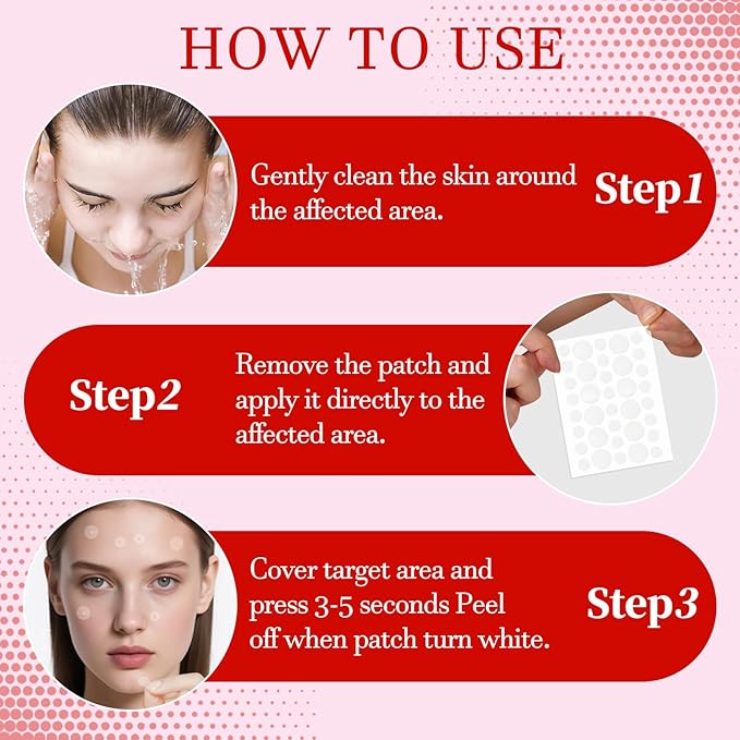 Pimple Patch (153 Count), Acne Patch Bulk, Zit Stickers 3 Sizes, Hydrocolloid Spot Stickers, Clear Acne Dots for Covering Zits, Blemishes and Breakouts