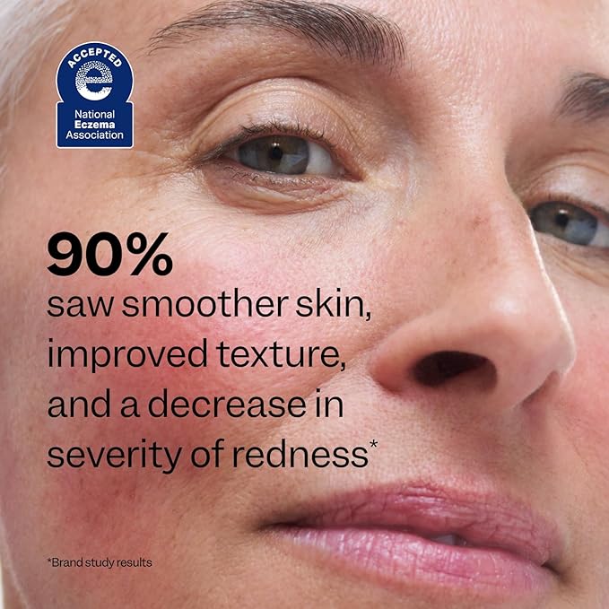 Peach Slices - Redness Relief 10% Azelaic Acid Serum (1.01 oz) - Advanced Skincare - Includes Panthenol, Cica, Algae - Vegan, Cruelty-Free, Korean Skincare & Beauty