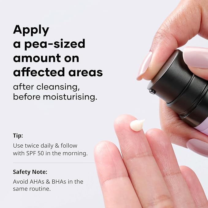 Cureskin Tranexamic Acid 10% Cream | 20,000 PPM Kojic Acid Dipalmitate, 15,000 PPM Alpha Arbutin, 100,000 PPM Tranexamic Acid | Dark spots, Freckle, Blemishes, Pigmentation (15g/0.5 Oz)