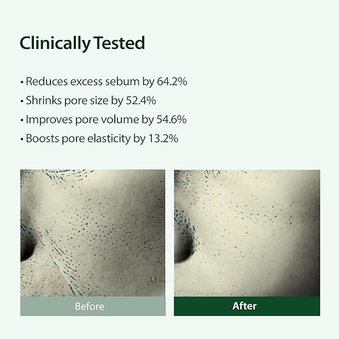 BLITHE Targeted Pore Serum with 22% Niacinamide for Oil Control, Pore Minimizer for Face, Korean Skin Care, K-Beauty Gift & Stocking Stuffer Idea – 1 fl oz