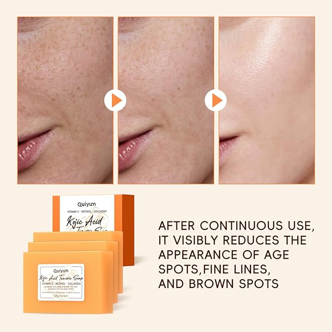 Kojic Acid Turmeric Soap, Dark Spot Remover for Face, Facial Skin Care Products, Even Skin Tone, Moisturizing & Nourishing, 3 Pack+ African Net Sponge, Christmas Gift Stocking Stuffers