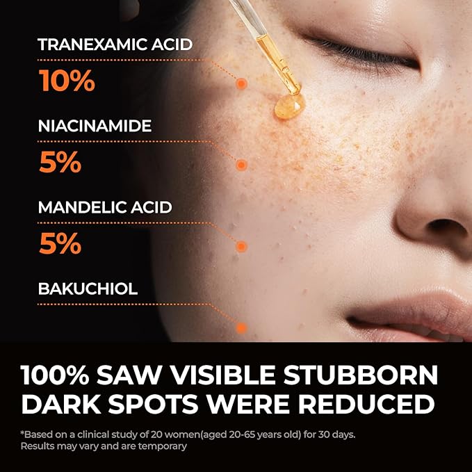 DOMINAS 10% Tranexamic Acid + 5% Mandelic Acid + 5% Niacinamide Brightening Serum, Powerful Dark Spot Corrector for Face, Fast Results in 2 Weeks, 1.01 fl oz