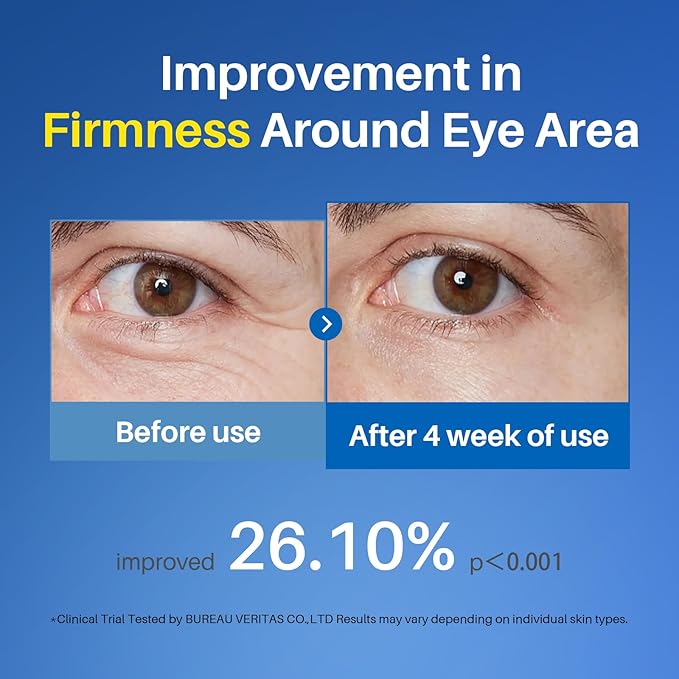 Caffeine Eye Cream, Under Eye Cream for Dark Circles, Puffiness & Puffy Bags, Wrinkles Fine Lines, Eye Roller Serum with 360° Massage Ball for Women and Men - 0.7 fl. oz