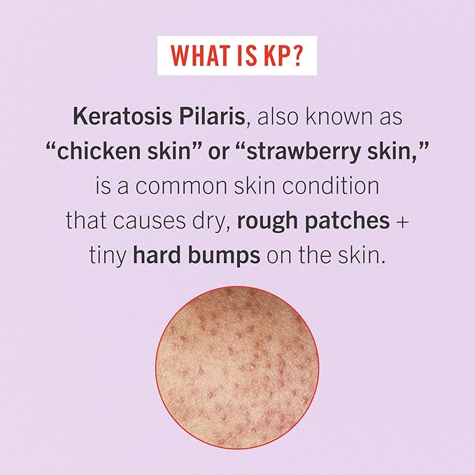 First Aid Beauty - Smooth Operators Trio: KP Bump Eraser Body Scrub, 8 oz, Smoothing Lotion, 6oz, and Ingrown Hair Pads, 28 Pads, Deep Moisture Exfoliating Skin Treatment Set with BHA & AHA, 3ct