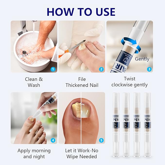 4-PACK Nail Fungus Pen - Toenail Fungus Treatment Extra Strength 25% Undecylenic Acid, Fast-Acting 7 Days Toe Nail Fungus Treatments, Tea Tree Oil, Acetic Acid Fungal Nail Repair Pens for Damaged Nail