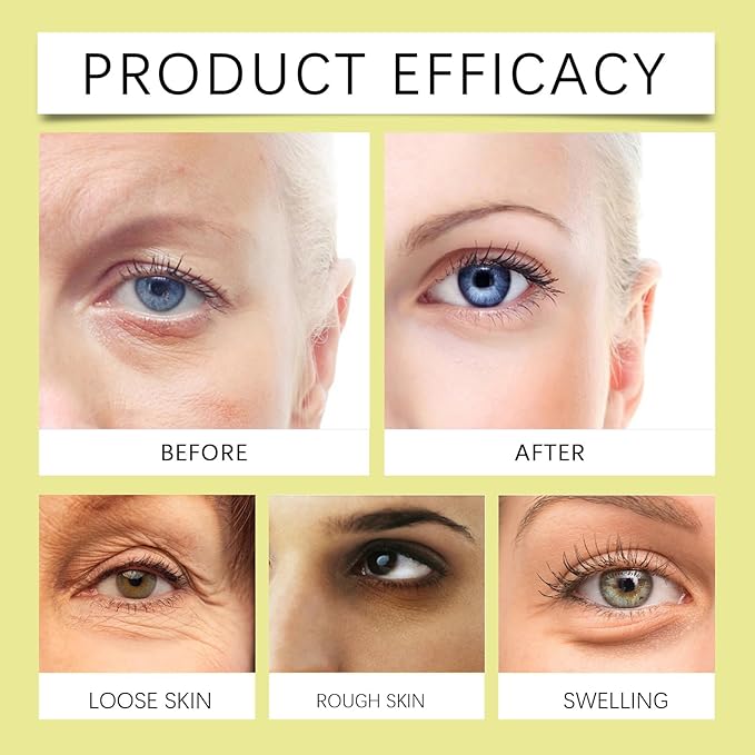 Soelegant Retinal Shot Tightening Booster for Firming Face & Eye Area, Dual Pack 15g Each, Wrinkle & Fine Line Care, Deep Hydration Cream with Retinaldehyde & Glycerin, Lightweight Non-Greasy Texture