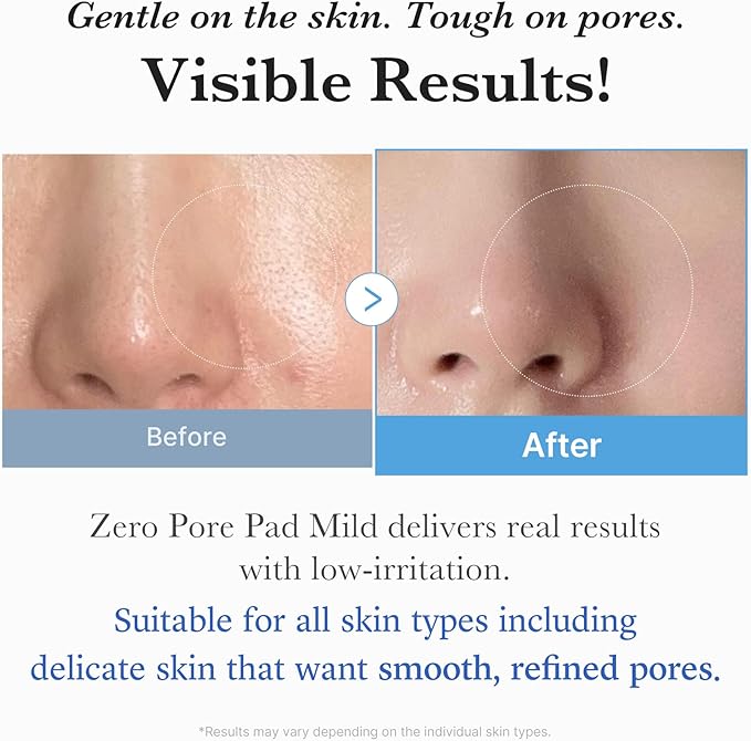 medicube Toner Pads Zero Pore Pad Mild 2.0 | Gentle Calming Toner Pad for Exfoliation, Minimizing Pores & Blackhead Removal with PHA | Ideal for All Skin Types | Korean Skin Care, 70 Pads (1 Pack)