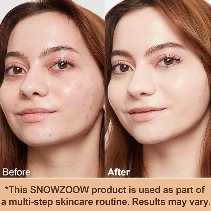 Color Changing Medium/Light 4 in 1 Hydrating full coverage concealer Foundation makeup Liquid-Longwearing & Waterproof- with SPF 50