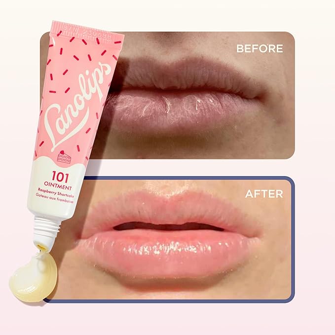 Lanolips 101 Ointment - Lanolin Lip Balm for Smooth, Hydrated & Healthy Lips - Multipurpose Lip Ointment with Lanolin Oil for Dry Lips, Cuticles & More - Raspberry Shortcake (0.52 oz)