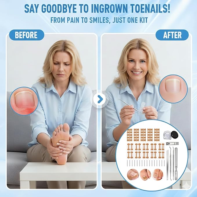 Ingrown Toenail Removal Kit, Professional Ingrown Toenail Corrector Set with Toenail Correction Strips, Curved Toenails Corrector Patch, Painless File and Lifter Pedicure Tools for Home Treatment