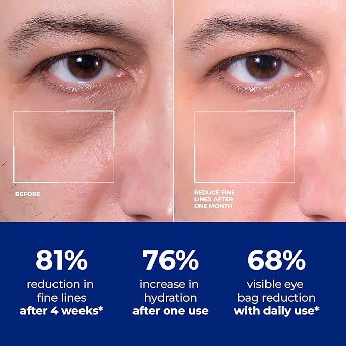 Mens Eye-Bags Treatment Cream: Under Eye Repair for wrinkles Baggy Puffiness and Dark Circles - Anti-aging Hydrating with Peptides + Hyaluronic Acid + Niacinamide + Botanical complex+VC
