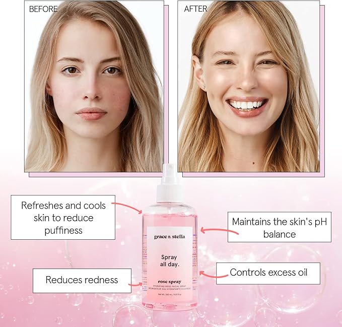 grace & stella Award Winning Rose Water Spray for Face with Glycerin & Aloe Vera - Travel Size (30ml) - Rosewater Face Mist for All Skin Types - Hydrating, Calming, Rejuvenating Facial Toner - Vegan