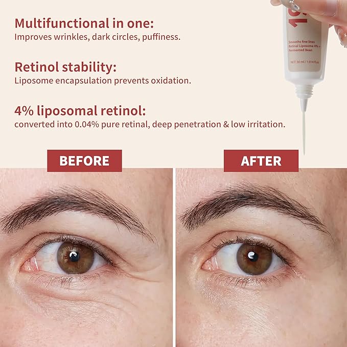 Retinol Anti Wrinkle Eye Cream,Dark Eyes Repair moisturizer With 4% Retinol,Niacinamide Eye Bag Care formula For Man&Woman,Multifunctional Treatment Essence,Anti-Aging&Improves Pigmentation,1.01 fl oz