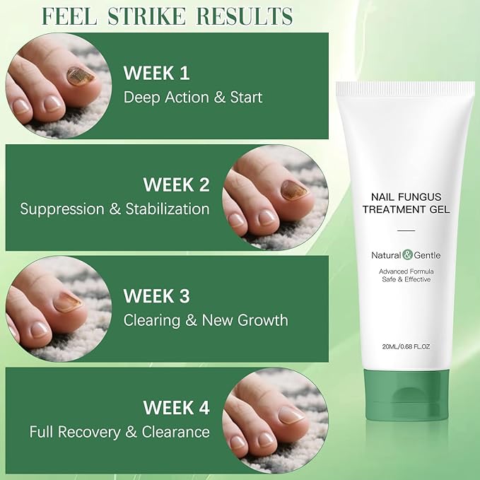 2PCS Nail Fungus Repair Gel – Multi-Purpose Nail Repair, Nail Growth Serum for Damaged Nail