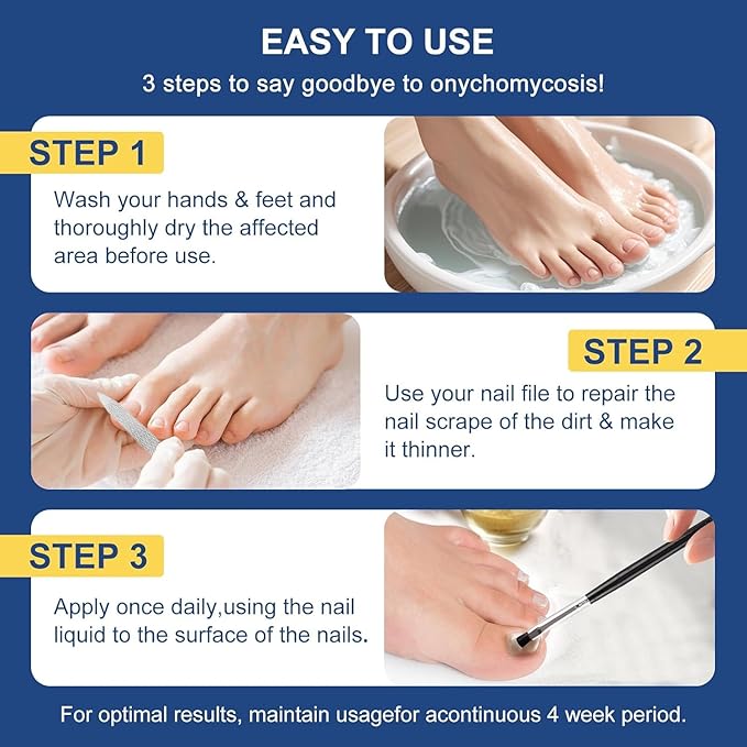 Toenail Fungus Treatment Extra Strength with 25% Undecylenic Acid, Ingrown toenail treatment, nail repair, Fungus nail treatment, yellow toenail, Damaged Nails foot fungus treatment （4Pack)