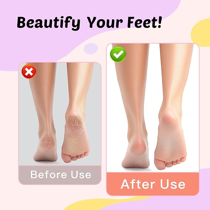 Dolcevitae Electric Foot Callus Remover & Nail File - Electric Callus Remover for Feet, 9 Adjustable Speeds, 1800mAh Rechargeable, Portable Aluminum Body w/Type-C Charging for Home & Travel (Purple)