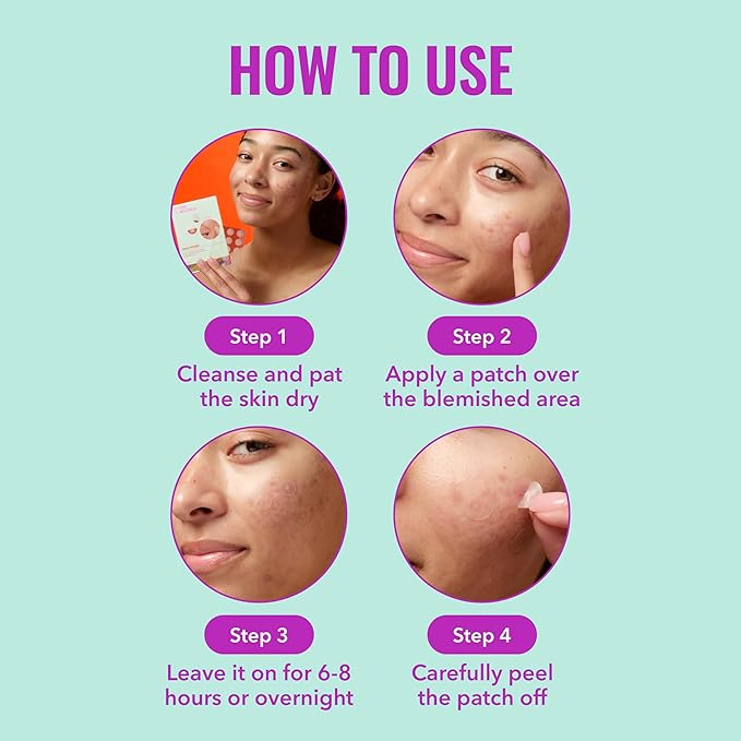 Good Molecules Pimple Patches Pack 3 – 180 Patches (60 × 3 Pack) | Ultra-Thin Hydrocolloid Acne Patches to Conceal Breakouts, Blackheads & Blemishes