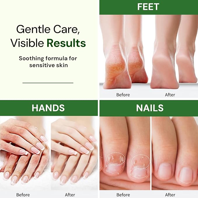 Natural Foot, Nail & Hand Cream - Skin Care & Nourishing Formula – Rich Hydration with Raspberry Scent, Daily Repair Cream for Men & Women, Softens, Protects & Restores Skin – 4oz