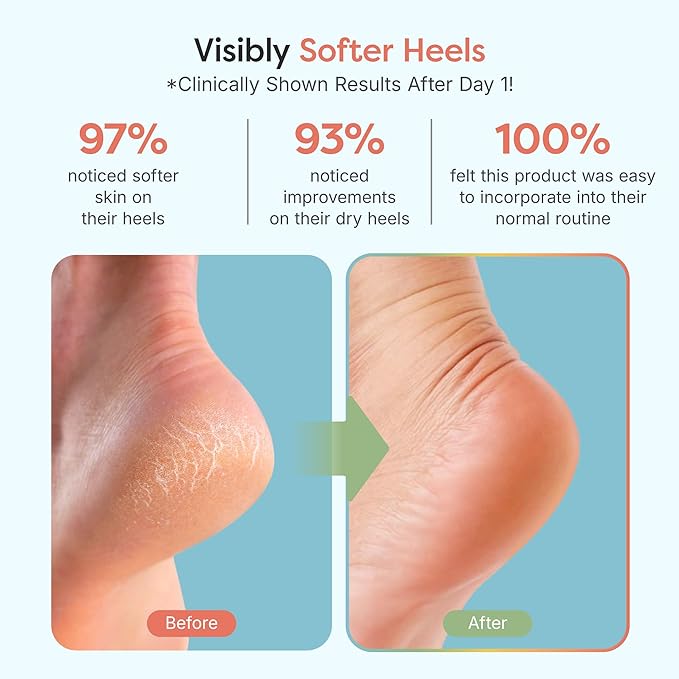 ZenToes Moisturizing Socks for Cracked Heel Treatment, Vitamin E, Olive Oil and Jojoba Oil Infused Heel Socks, Galentines Day Gifts, Self Care Gifts for Women (Fuzzy Blue, Regular)