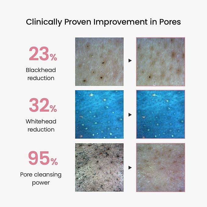 BIODANCE Collagen Cleansing Oil, Facial Oil Cleanser, Gentle Makeup Remover, Removes Bleackhed and Whitehead for Sensitive Skin, Oily Skin, Korean Skin Care, Gifts for Womenㅣ6.76 fl. oz. (200 ml)