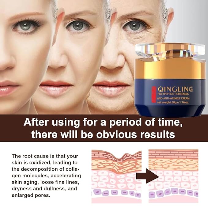 Qingling Face Cream, Qingling Crema Para Arrugas, Qingling Wrinkle Removal Cream, Polypeptide Tightening and Anti-Wrinkle Cream, Firming Anti-aging Eye Cream for Women Men (1)