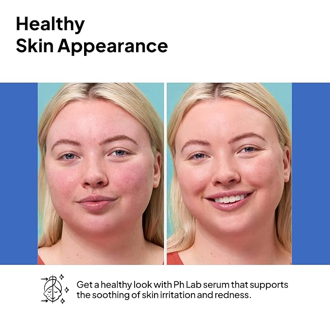 Anti Redness Serum, Reduces Capillary Cracks Appearance, Evens Skin Tone, Skin Soothing and Redness Reform Serum, 1.01 Fl Oz (Pack of 1)