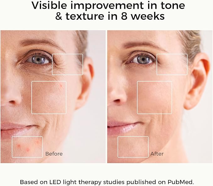 Red Light Therapy Mask for Face – Infrared Wireless LED Face Mask with 3 Modes, Portable Cordless Anti-Aging Light Therapy for Wrinkle Reduction, Acne Care & at-Home Skin (White)