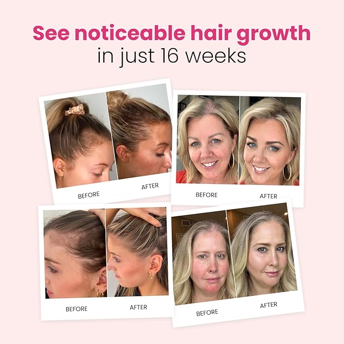 Trybello Hair Growth Shampoo | Natural Thickening & Scalp Detox | Sulfate Free, Vegan, Anti-Hair Fall Formula | Caffeine, Aloe Vera, Turmeric, and Urucum Extract | For Any Hair Type