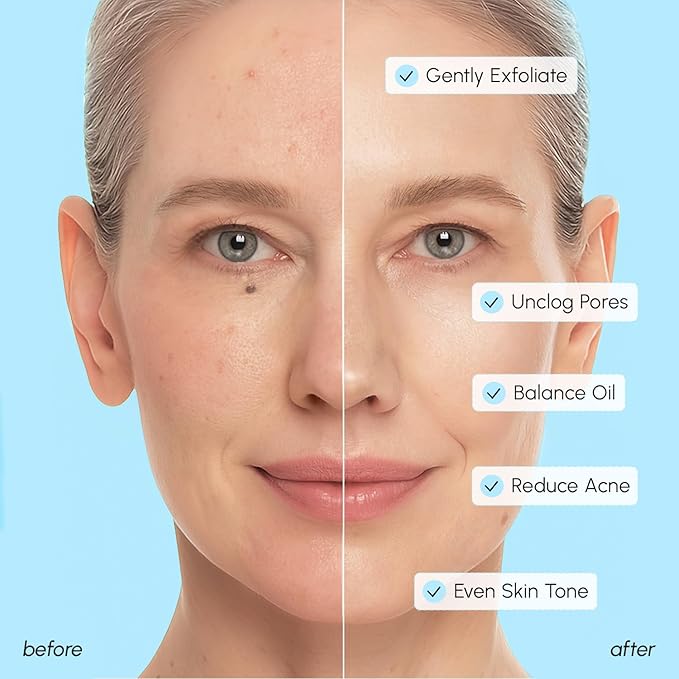 MAREE Glycolic Acid Pads & 2% Salicylic Acid – Toner Pads for Face with 20% Glycolic Acid Solution – Face Exfoliating Pads, Acne Clearing Face Pads – Skin Pore Resurfacing & Radiance Device – 50 Count