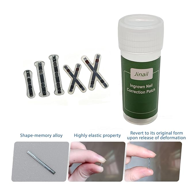 10-Piece Pack Titanium Alloy Ingrown Toenail Corrector,Curved Toenail Repair Patch,Memory Metal Ingrown Toenail Physical Correction Tool,Ingrown Toenail Removal Tool Set,Nail Aesthetic Shaping Tools.