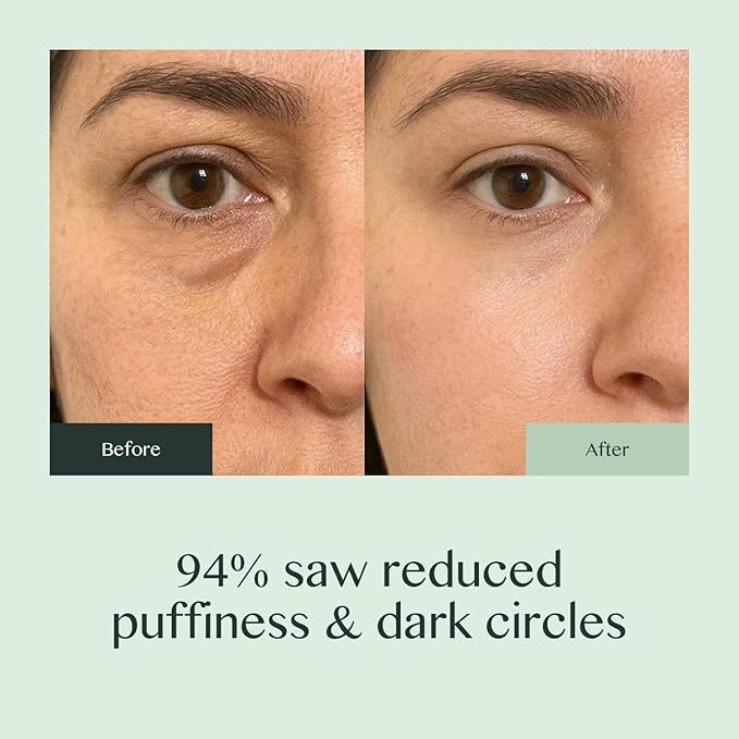 Caffeine Eye Cream for Dark Circles and Puffiness – Moonstone Under Eye Cream with Cooling Tip, Retinol, Hyaluronic Acid & Peptides – for Wrinkles, Bags, Fine Lines – Fragrance-Free