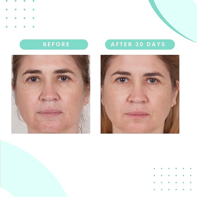 Serious Skincare Glycolic Cleanser - Daily Non-Drying Exfoliating Face Wash - 10% Glycolic Acid - Deep Pore Purifying - Removes Blackheads, Makeup & Impurities 4 Fl. Oz.