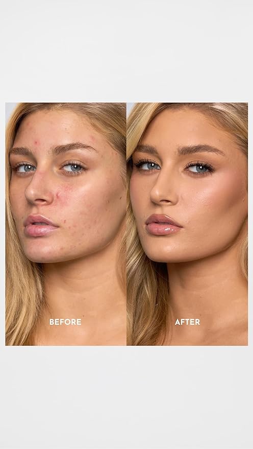 LAWLESS Women's Forget the Filler Skin-Plumping Line-Smoothing Foundation, 4L, light with neutral undertones, 1.0 Ounce