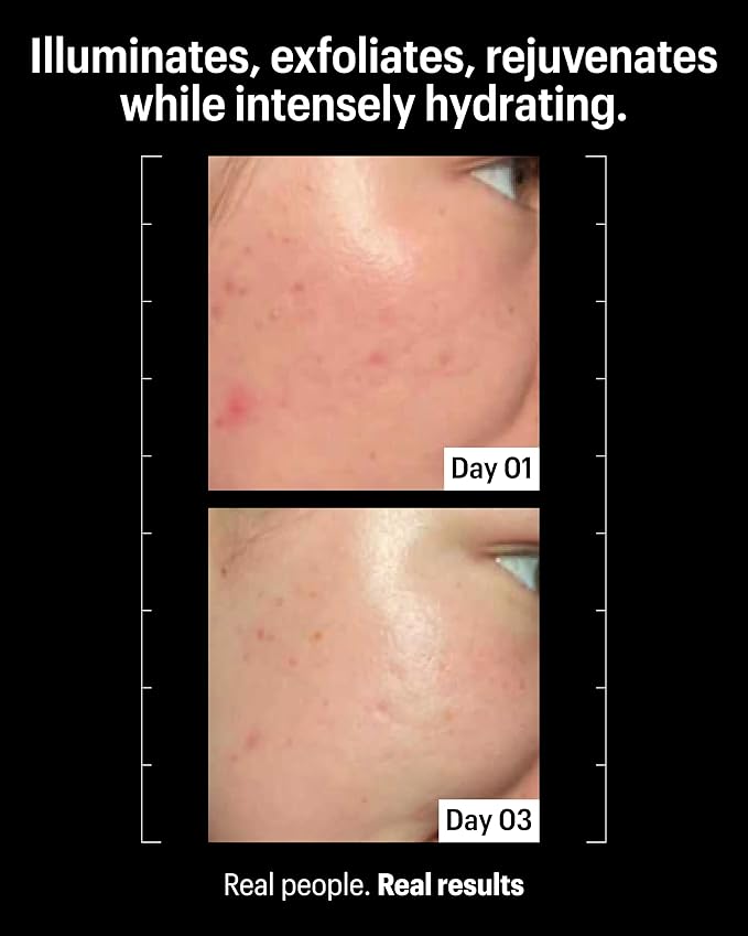 Allies of Skin Multi Acids & Retinoid Sleeping Facial | Exfoliating Overnight Glycolic Acid & AHA Peel | Resurfacing Anti-Aging Treatment For Fine Lines | Unclog Pores and Treat Blackheads 1.6 fl oz