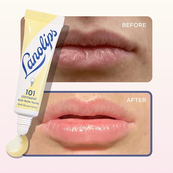 Lanolips 101 Ointment - Lanolin Lip Balm for Smooth, Hydrated & Healthy Lips - Multipurpose Ointment with Lanolin Oil for Dry Cuticles & More - Online Exclusive - Vanilla (0.35 oz)