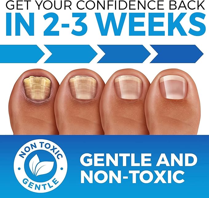 Toe & Toenail Fungus and Nail Fungus Treatment (FDA REGISTERED) - Damaged Yellow Nail Care - Extra Strength Nail Care Discolored Brittle Toenails - XL - Nail Mycosis Improved Formula (Made in USA)