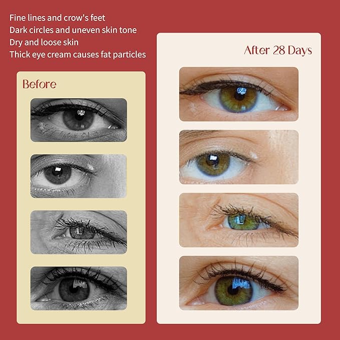 Retinol Anti Wrinkle Eye Cream,Dark Eyes Repair moisturizer With 4% Retinol,Niacinamide Eye Bag Care formula For Man&Woman,Multifunctional Treatment Essence,Anti-Aging&Improves Pigmentation,1.01 fl oz