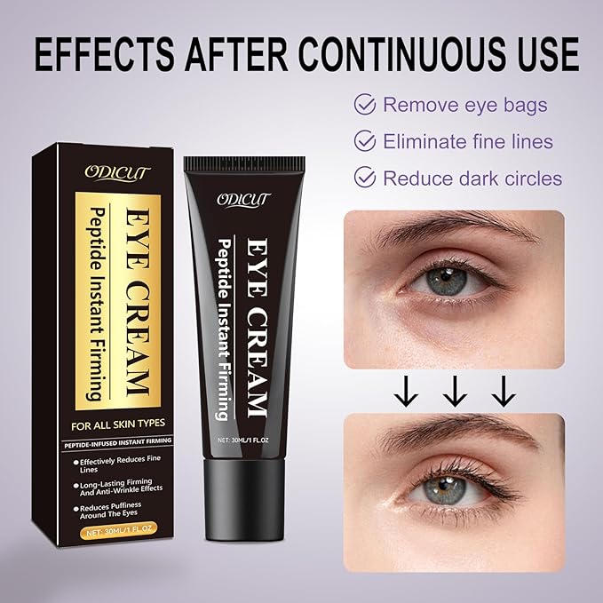 Temporary Instant Eye Tightener Cream – Under Eye Cream for Men & Women, Helps Improve the Appearance of Dark Circles, Puffiness & Fine Lines, Anti-Aging & Firming, Mild Hydrating Formula, 30 ML