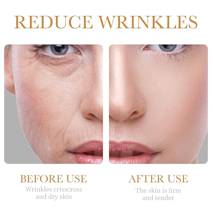 Collagen Skin Care Set, 6Pcs Anti Aging Face Care Sets for Women, Firming Skin, Shrink Pores, Smooth Wrinkles, Hydrating Skin Care Set Include Serum Face Cream Eye Cream Toner Cleanser Facial Mask1