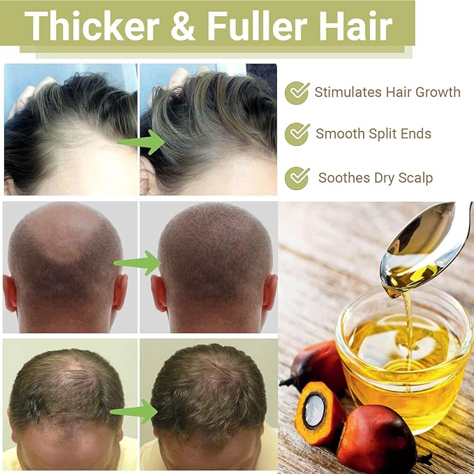 RAW Batana Oil for Hair Growth, Dr Sebi Organic Unrefined Batana Oil from Honduran, 100% Pure & Natural Hair Growth for Thicker & Stronger Hair - 2 FL OZ - 60Ml - 1Pack