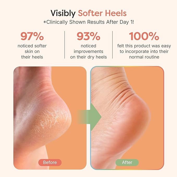 ZenToes Moisturizing Socks for Cracked Heel Treatment, Vitamin E, Olive Oil and Jojoba Oil Heel Socks, Stocking Stuffers for Women, Spa Self Care Gifts for Women (Fuzzy Blue and Pink, Regular)