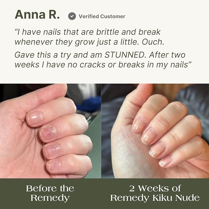 Botanist The Remedy | Nail Strengthening Polish | Repairs & Hardens Nails Damaged from Acrylics, Dip & Gel Manicures | Non-Toxic, 84% Plant Based, 21-Free & Vegan (Nude)