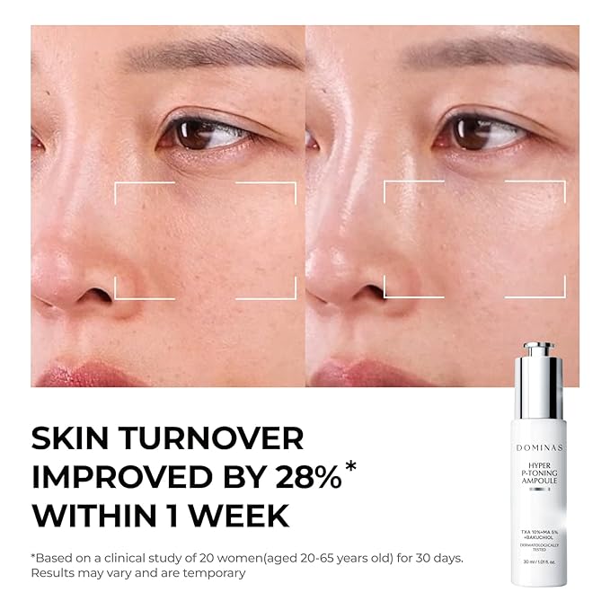 DOMINAS 10% Tranexamic Acid + 5% Mandelic Acid + 5% Niacinamide Brightening Serum, Powerful Dark Spot Corrector for Face, Fast Results in 2 Weeks, 1.01 fl oz