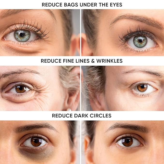 Instant Ageless Eye Cream-Instantly Reduces Under Eye Bags, Wrinkles, Dark Circles, Fine Lines & Crow's Feet. Powerfully Tighten & Lifts Sagging Skin that last Hours.