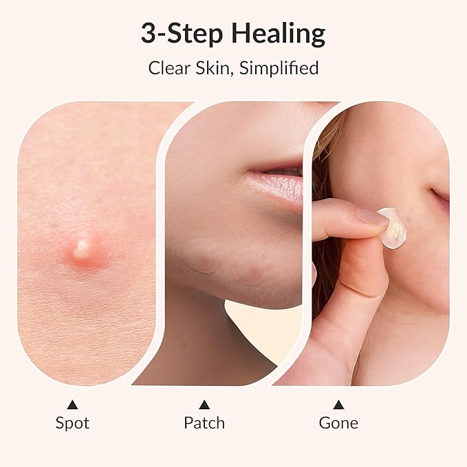 Korean Pimple Patches – Invisible Acne Stickers with Salicylic Acid & Hydrocolloid, Miracle Patches for Pimples Zit Stickers Blemish Dots Pimple Stickers for Face Overnight Healing - 72 Count