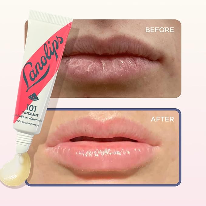 Lanolips 101 Ointment - Lanolin Lip Balm for Smooth, Hydrated & Healthy Lips - Multipurpose Lip Ointment with Lanolin Oil for Dry Lips, Cuticles & More - Watermelon (0.52 oz)
