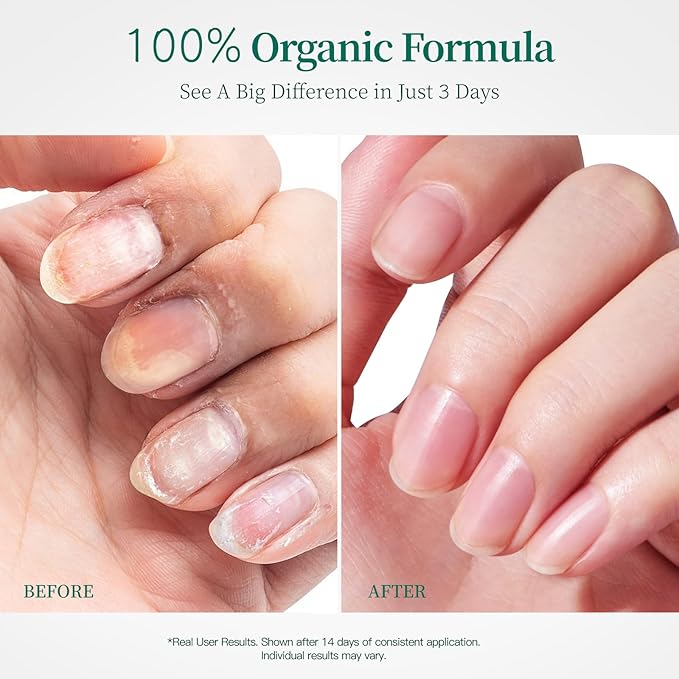 Apuree 1oz Bio-Based Cuticle Oil: 100% Pure| Deep Moisture for Damaged Cuticles| Black Rose Extract| USDA Verified & Cold Pressed Oil Hexane Free| Daily Nail Care| All Skin Types| Vegan