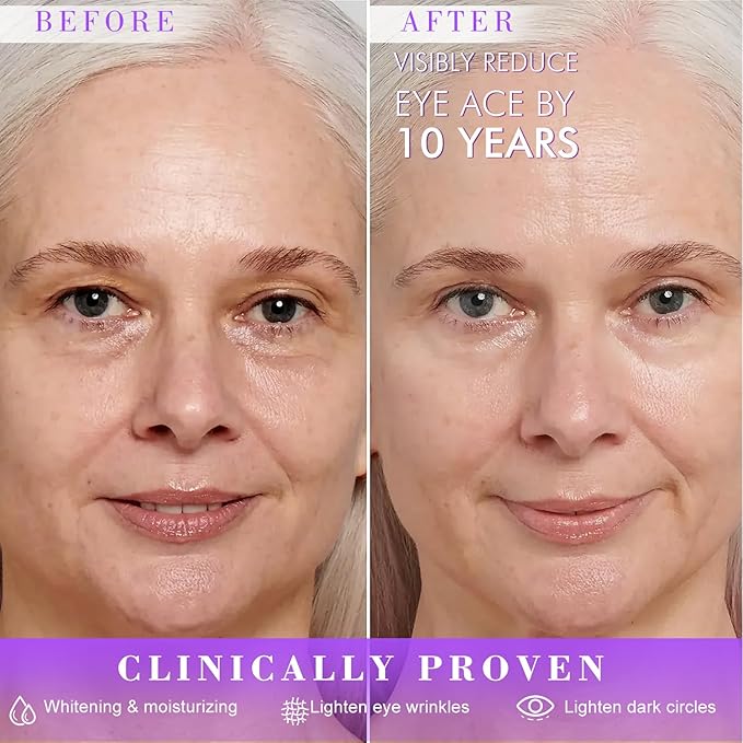 Eye Cream, Under Eye Cream Anti Aging For Puffiness Dark Circles Reduces, Wrinkle & Fine Line Reduction, Eliminate Puffiness, Ritch in 5% Niacinamide Acids for Brighter, Firmer Skin